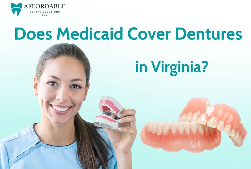 Does Medicaid Cover Dentures in Virginia? Full Guide & Eligibility